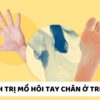 Cách trị ra mồ hôi tay chân ở trẻ em