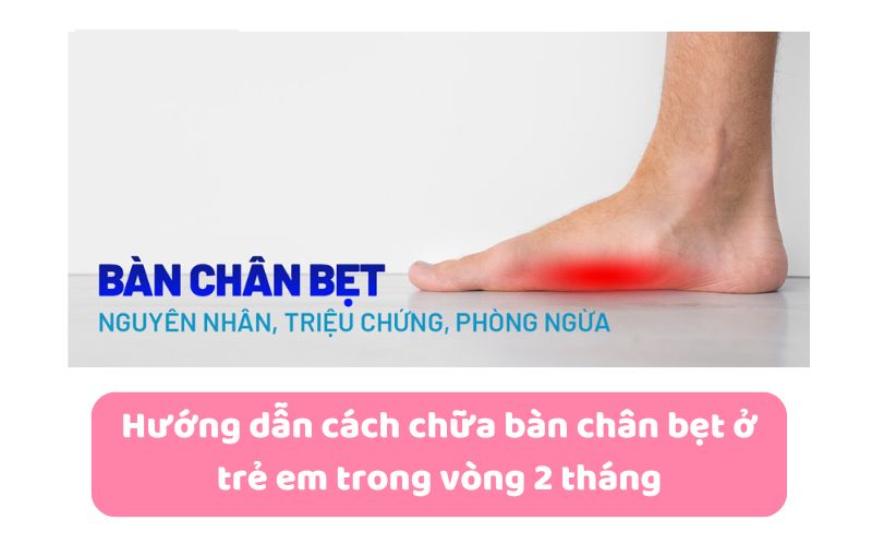 Hướng dẫn cách chữa bàn chân bẹt ở trẻ em trong vòng 2 tháng