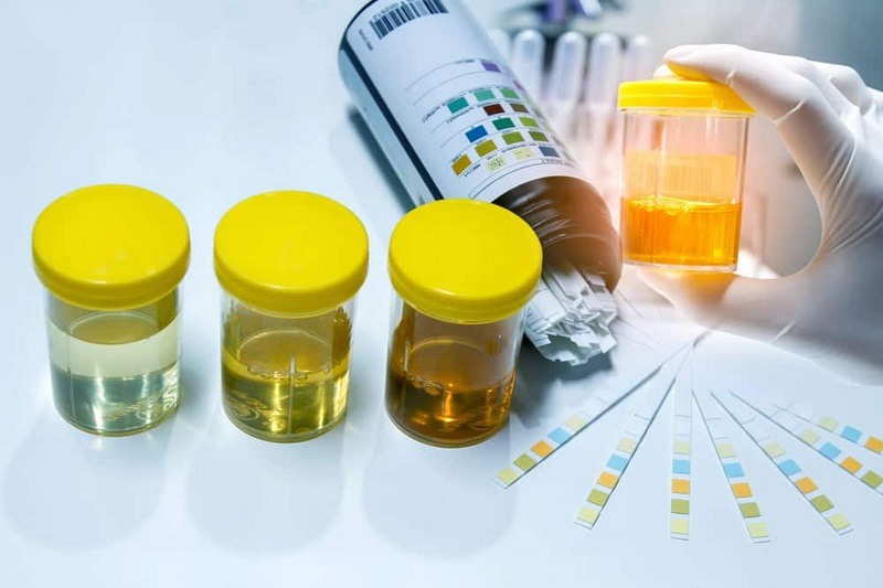 Mẹo phân loại tình trạng sức khỏe trẻ qua sắc độ nước tiểu
